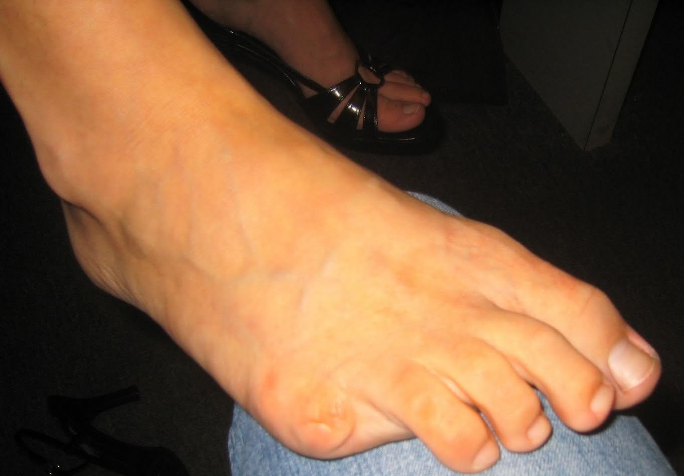 Causes of a Lost Toe - Almawi Limited The Podiatry Clinic