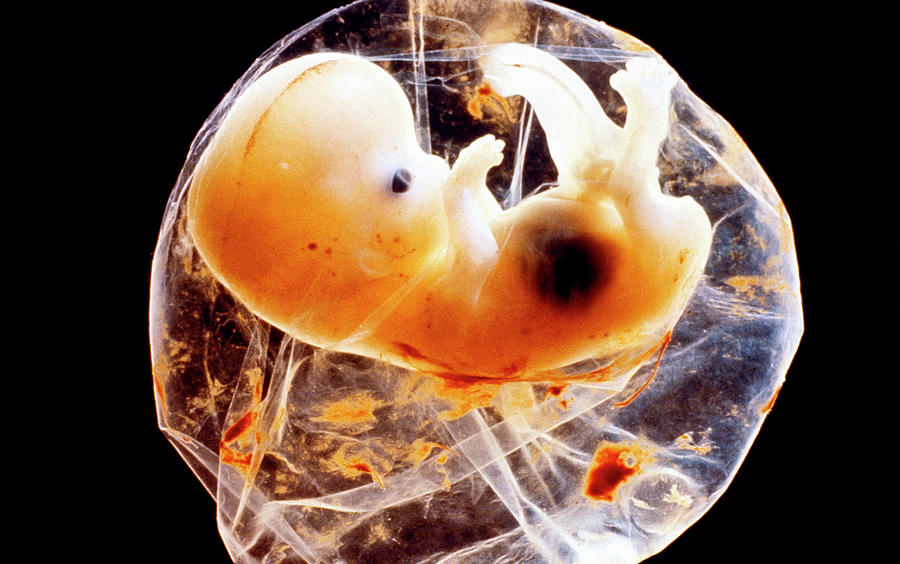 six-week-old-embryo-biophoto-associatesscience-photo-library.jpg